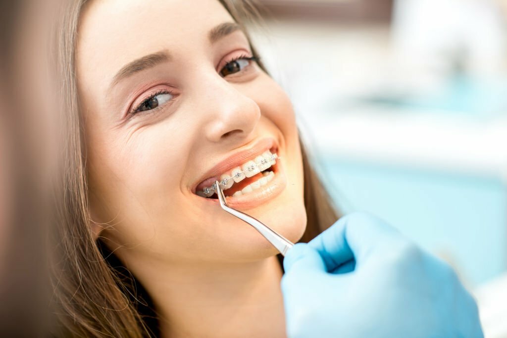 Exploring The Benefits Of Jacksonville Orthodontics