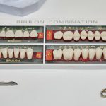 Maintaining Your Porcelain Veneers: Tips for Longevity and Durability_FI
