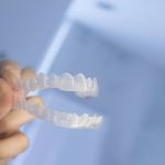 Cherokee Dental Professionals Guide to Invisalign in Jacksonville – What You Need to Know_FI