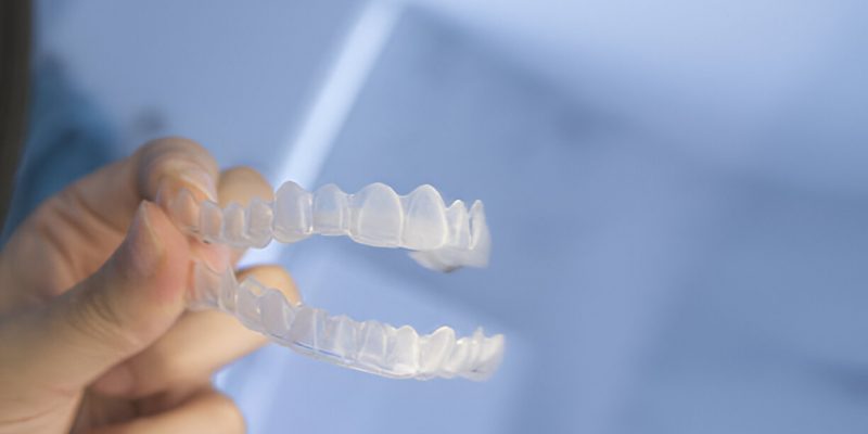 Cherokee Dental Professionals Guide to Invisalign in Jacksonville – What You Need to Know_FI