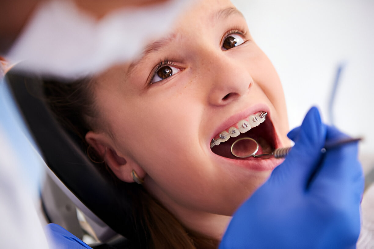 Complete Overview of Orthodontic Treatment at Cherokee Dental Professionals in Jacksonville_2