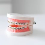 Complete Overview of Orthodontic Treatment at Cherokee Dental Professionals in Jacksonville_FI