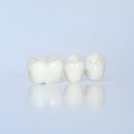 How to Care for Your Dental Crowns: Tips from Cherokee Dental Professionals in Jacksonville_FI