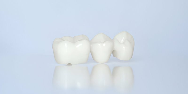 How to Care for Your Dental Crowns: Tips from Cherokee Dental Professionals in Jacksonville_FI