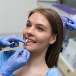 Comparing Porcelain Veneers to Teeth Whitening in Jacksonville, TX: Which Is Right for Your Smile?