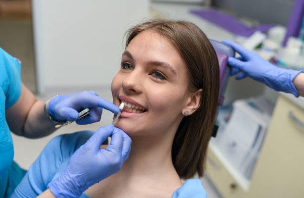 Comparing Porcelain Veneers to Teeth Whitening in Jacksonville, TX: Which Is Right for Your Smile?