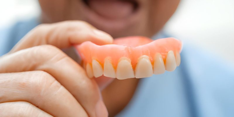 Missing Teeth? Explore Removable Dentures at Cherokee Dental Professionals_FI