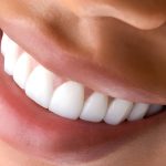 From Stained to Stunning: Teeth Whitening Results at Cherokee Dental Professionals_FI
